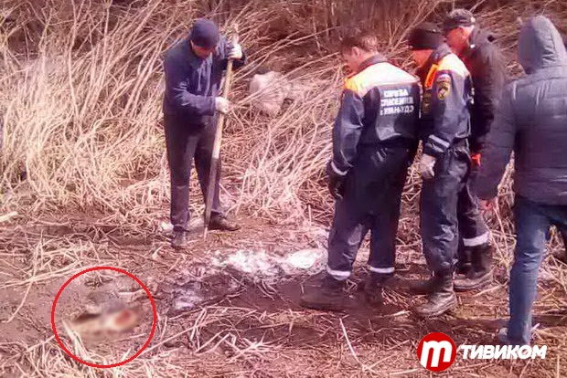 Как записаться в поликлинику на прием к гинекологу